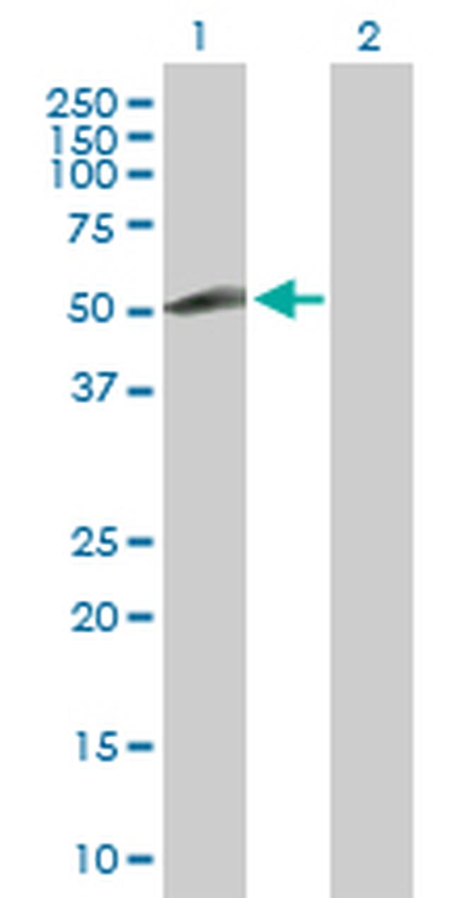 ZNF232 Antibody in Western Blot (WB)