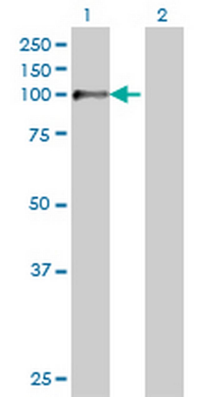 ZP2 Antibody in Western Blot (WB)