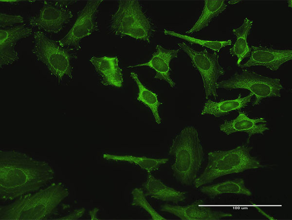ZYX Antibody in Immunocytochemistry (ICC/IF)