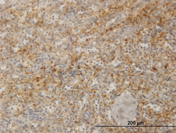 ZYX Antibody in Immunohistochemistry (Paraffin) (IHC (P))
