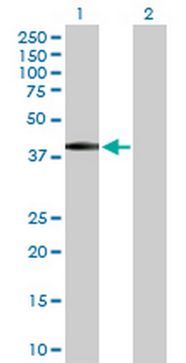 BSND Antibody in Western Blot (WB)