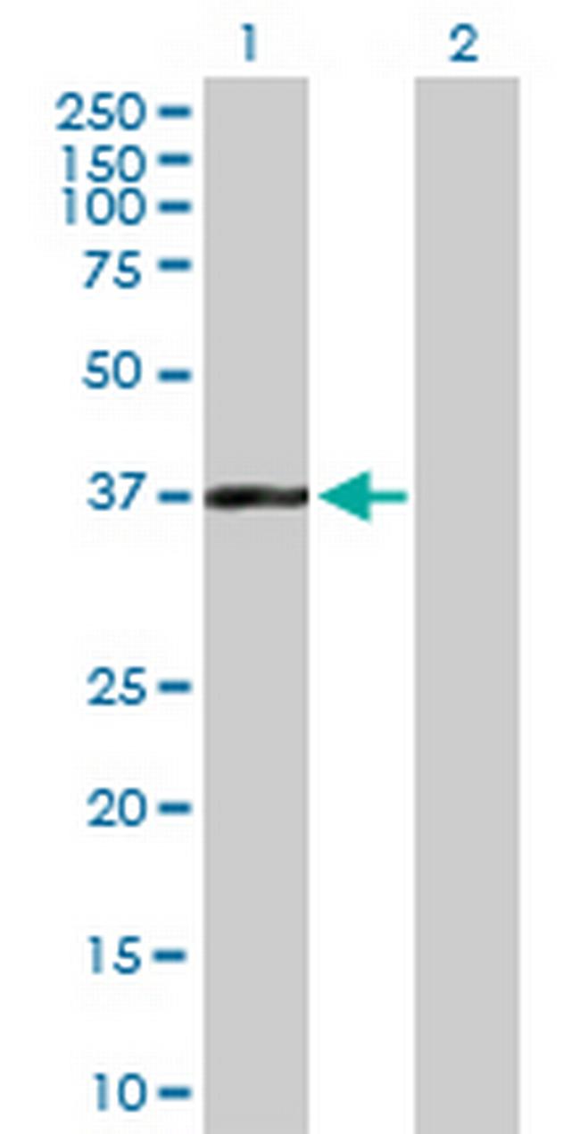 BAT4 Antibody in Western Blot (WB)