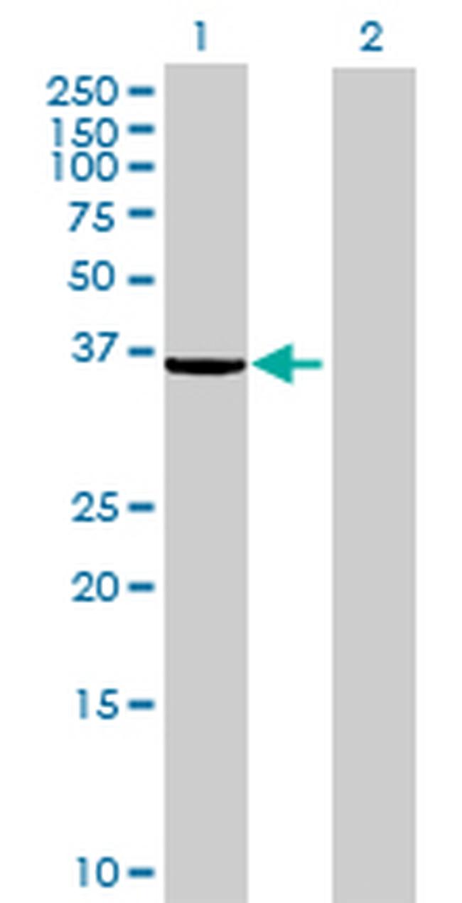EPM2A Antibody in Western Blot (WB)