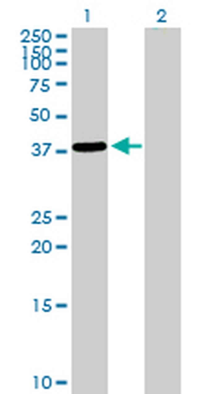EPM2A Antibody in Western Blot (WB)