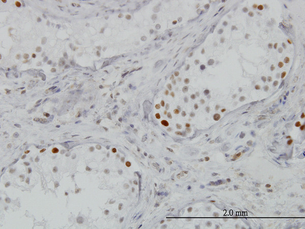 BRD3 Antibody in Immunohistochemistry (Paraffin) (IHC (P))