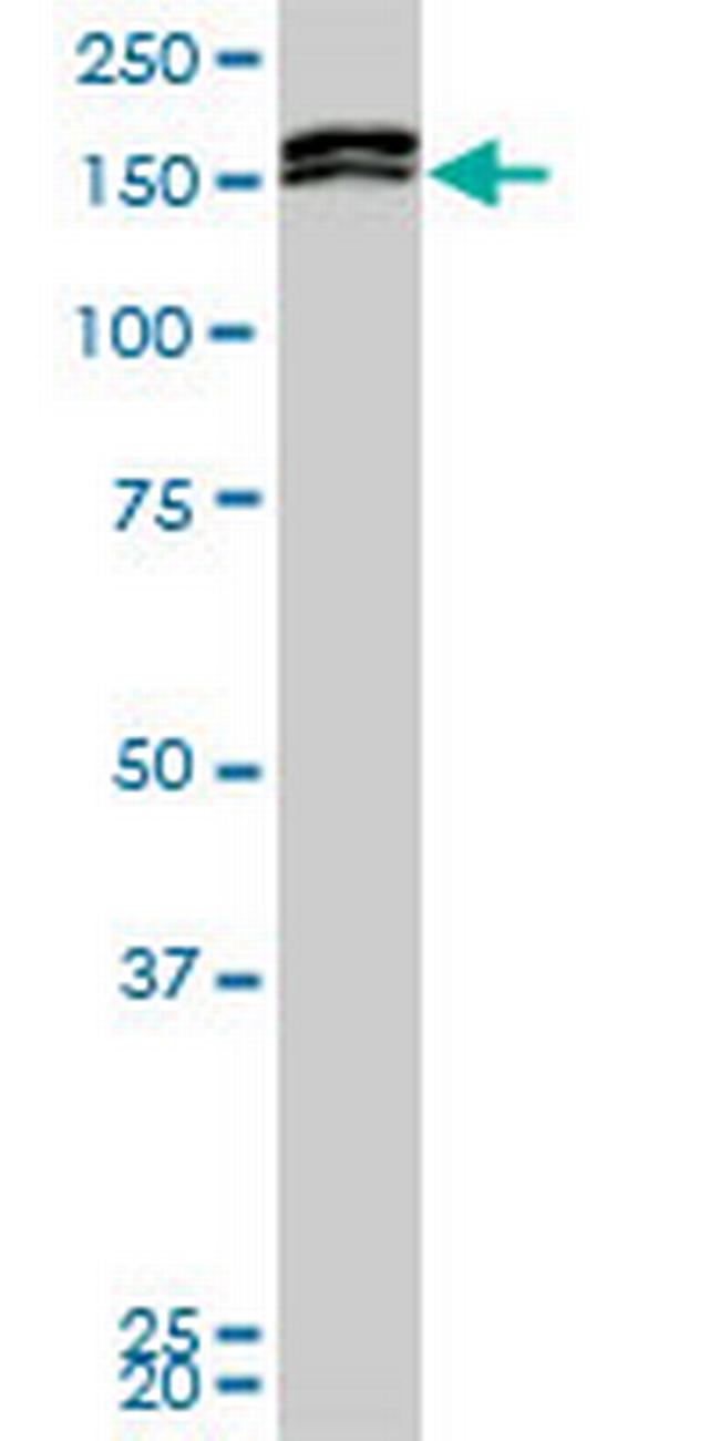 MLLT10 Antibody in Western Blot (WB)