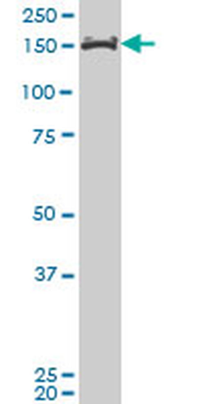 MLLT10 Antibody in Western Blot (WB)