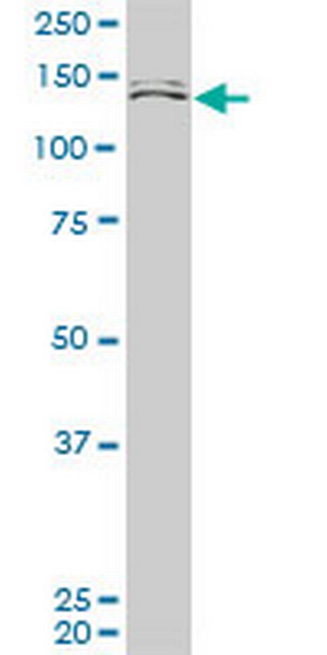 MLLT10 Antibody in Western Blot (WB)