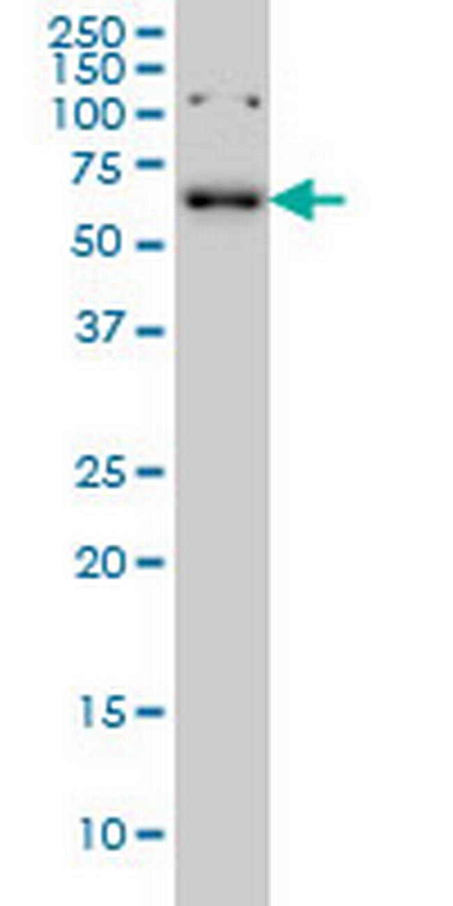 CCDC6 Antibody in Western Blot (WB)