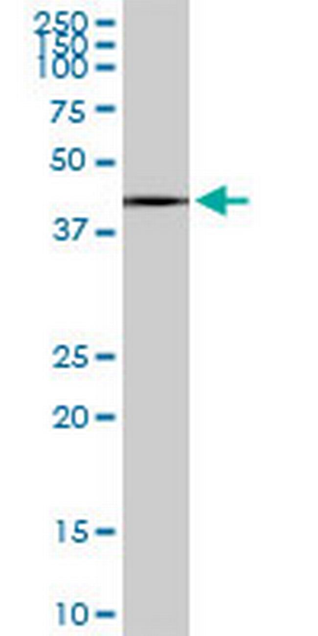 SLC25A16 Antibody in Western Blot (WB)