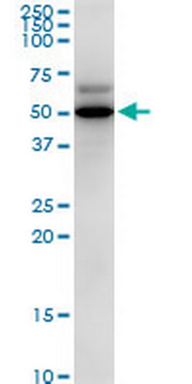 PDHX Antibody in Western Blot (WB)