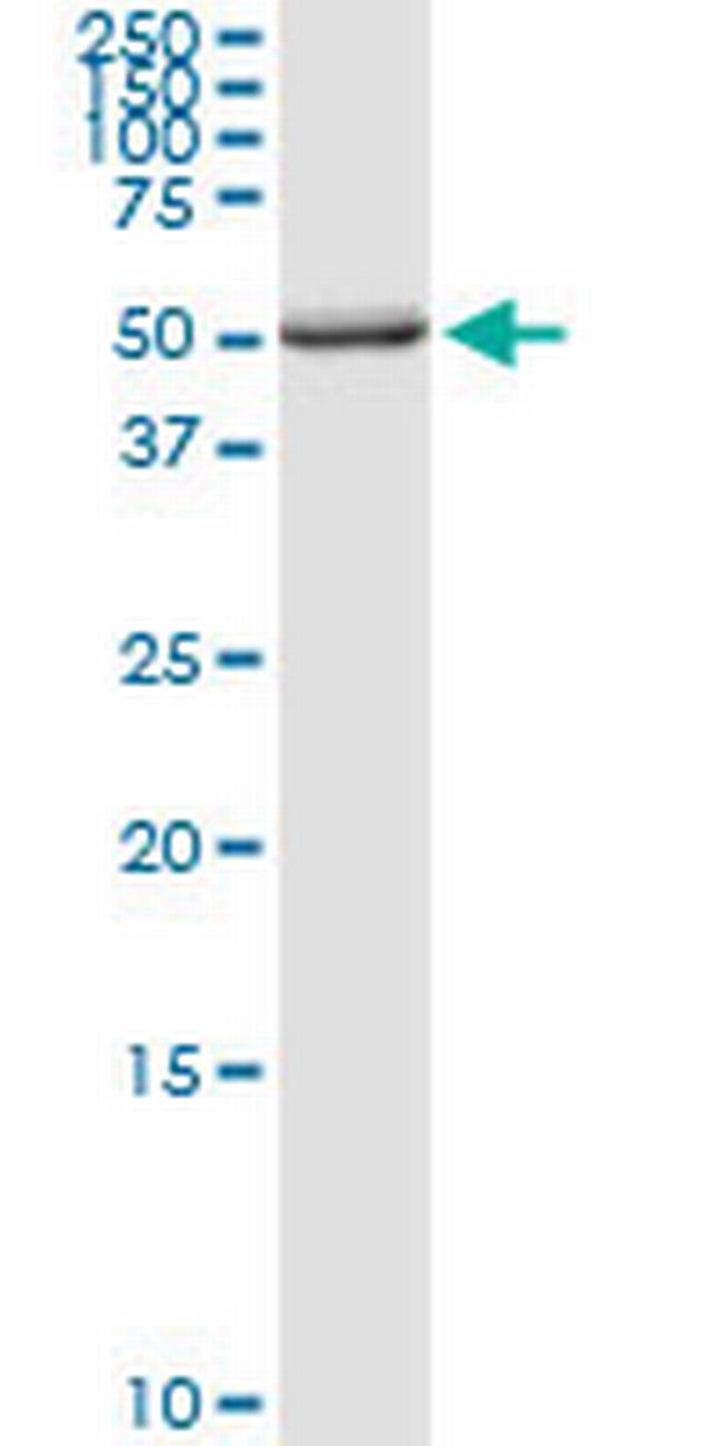 PDHX Antibody in Western Blot (WB)