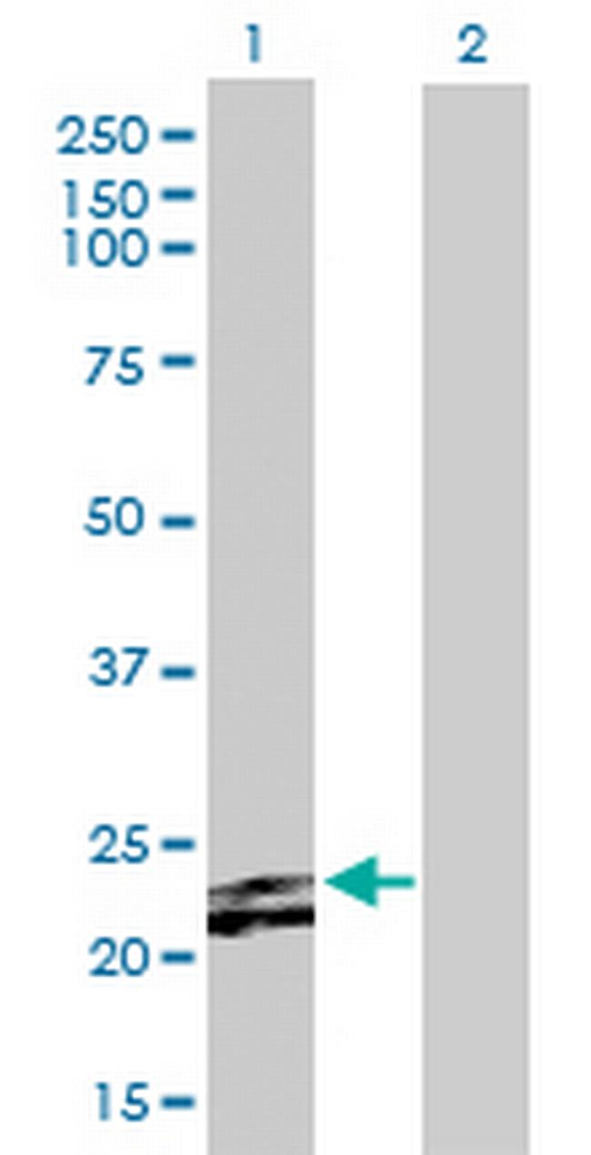 FGF23 Antibody in Western Blot (WB)
