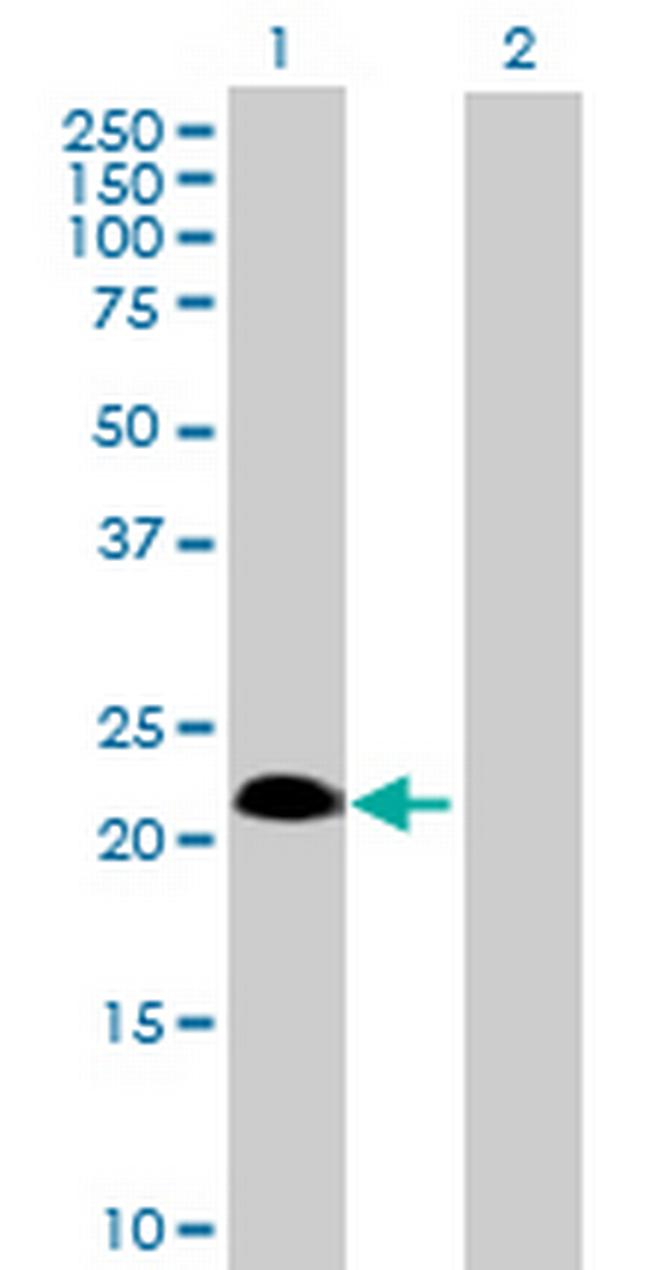 SSPN Antibody in Western Blot (WB)