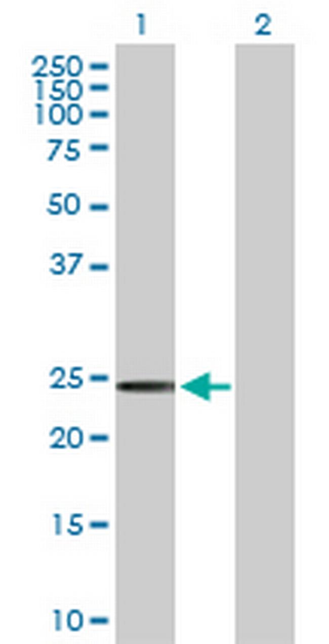 SSPN Antibody in Western Blot (WB)