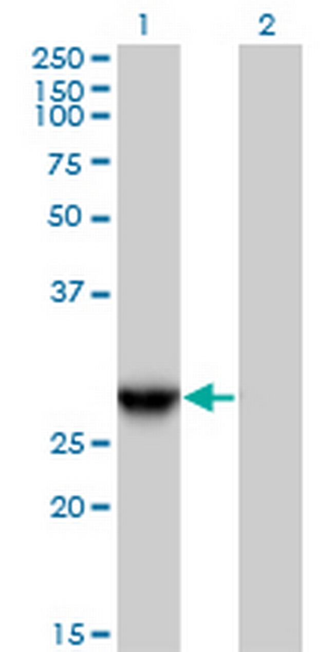 YEATS4 Antibody in Western Blot (WB)