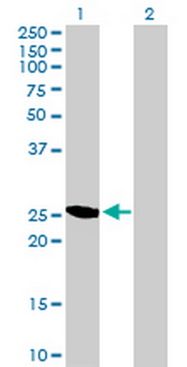 YEATS4 Antibody in Western Blot (WB)