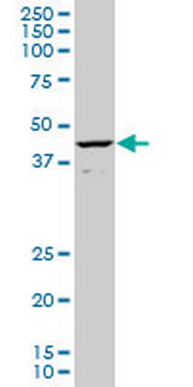 CART1 Antibody in Western Blot (WB)