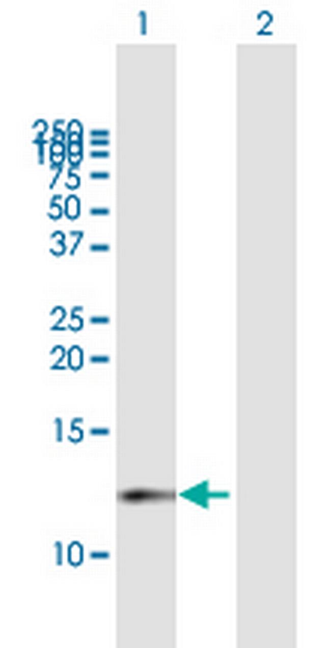 CDK2AP1 Antibody in Western Blot (WB)