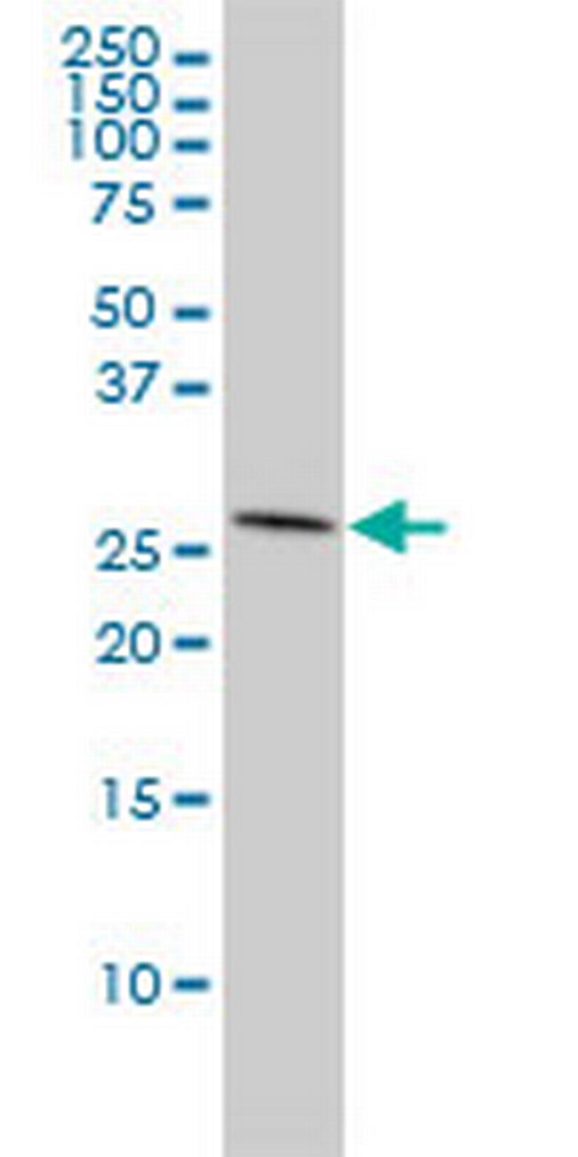 ANP32A Antibody in Western Blot (WB)