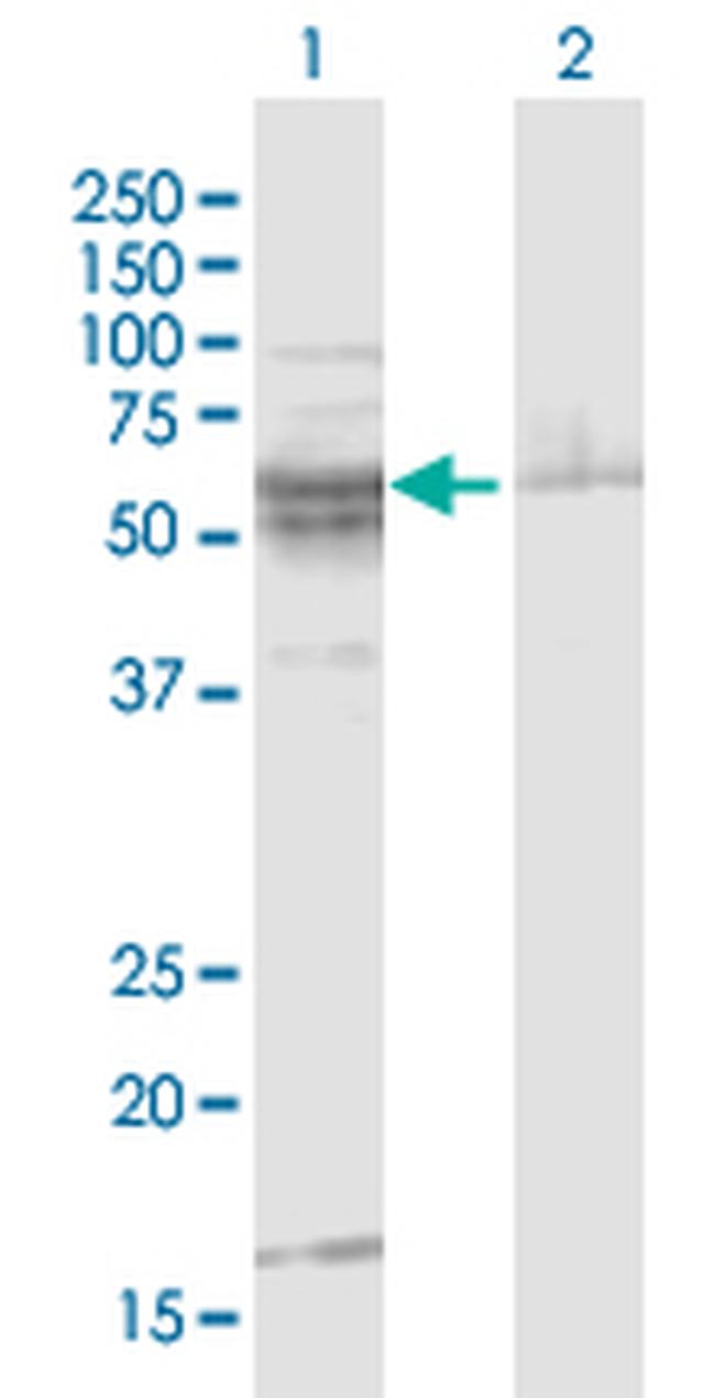 ST8SIA2 Antibody in Western Blot (WB)