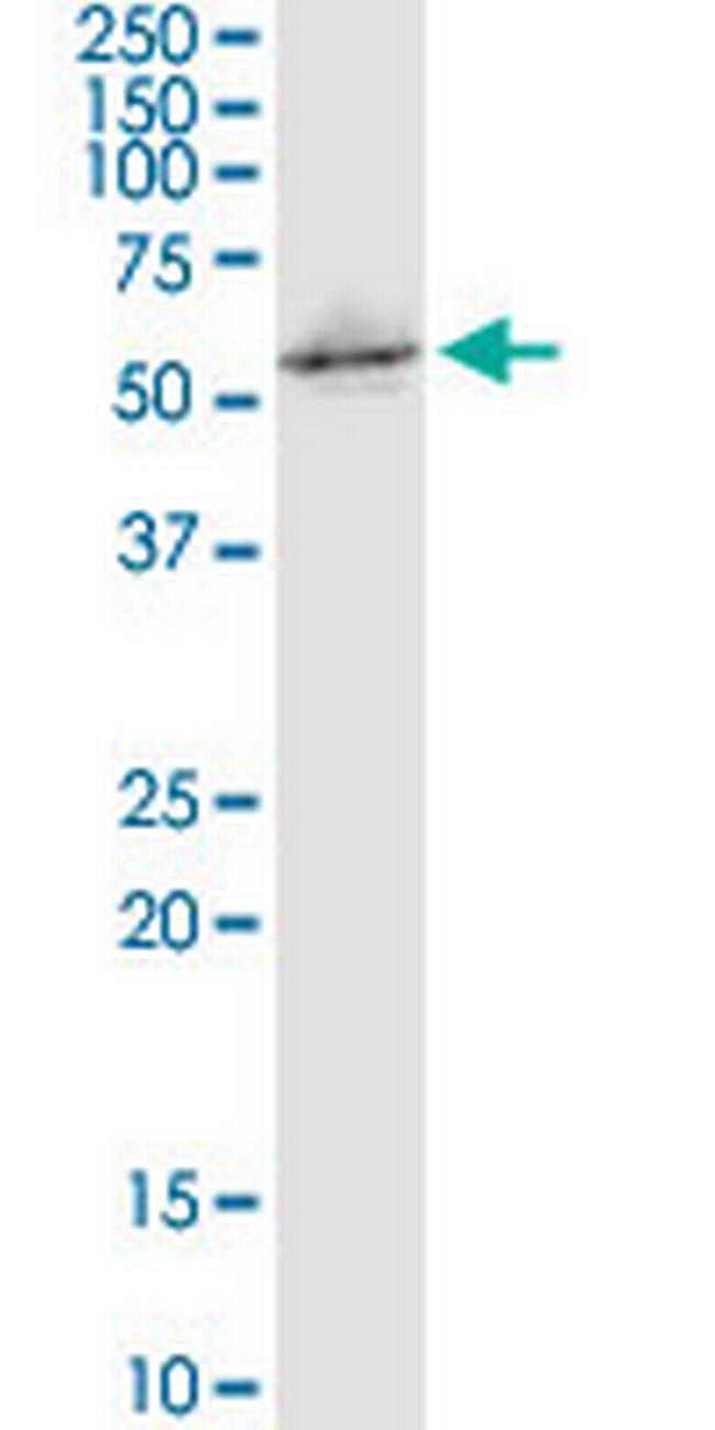 C16orf35 Antibody in Western Blot (WB)