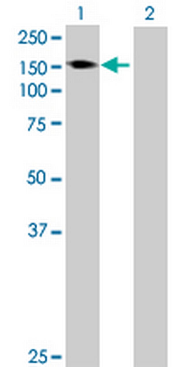 AKAP1 Antibody in Western Blot (WB)
