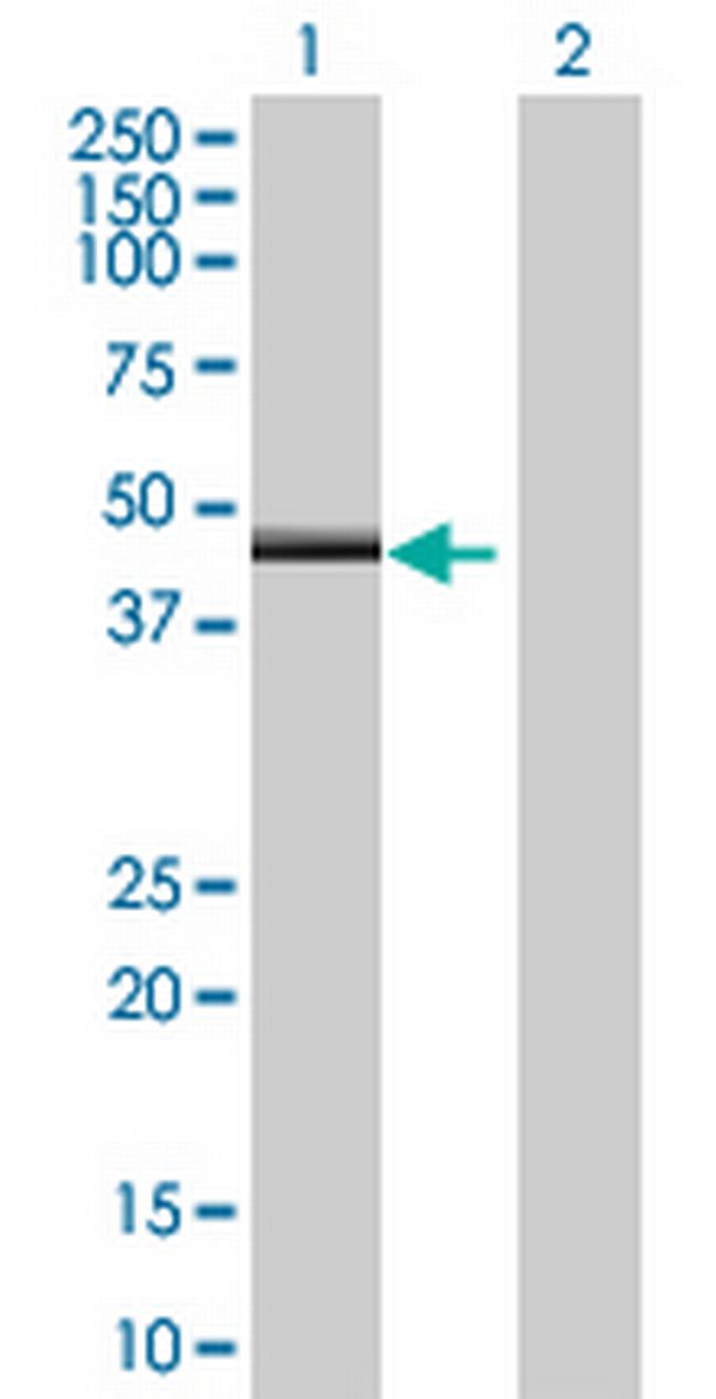 ZNF239 Antibody in Western Blot (WB)