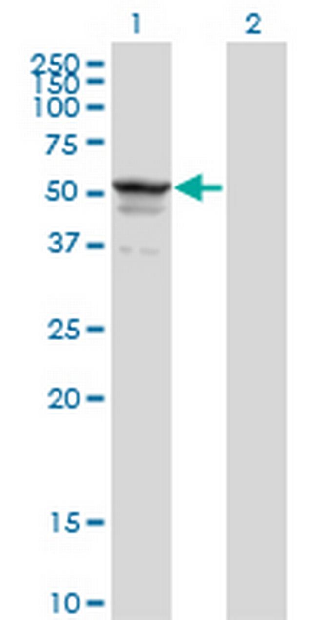 SYMPK Antibody in Western Blot (WB)