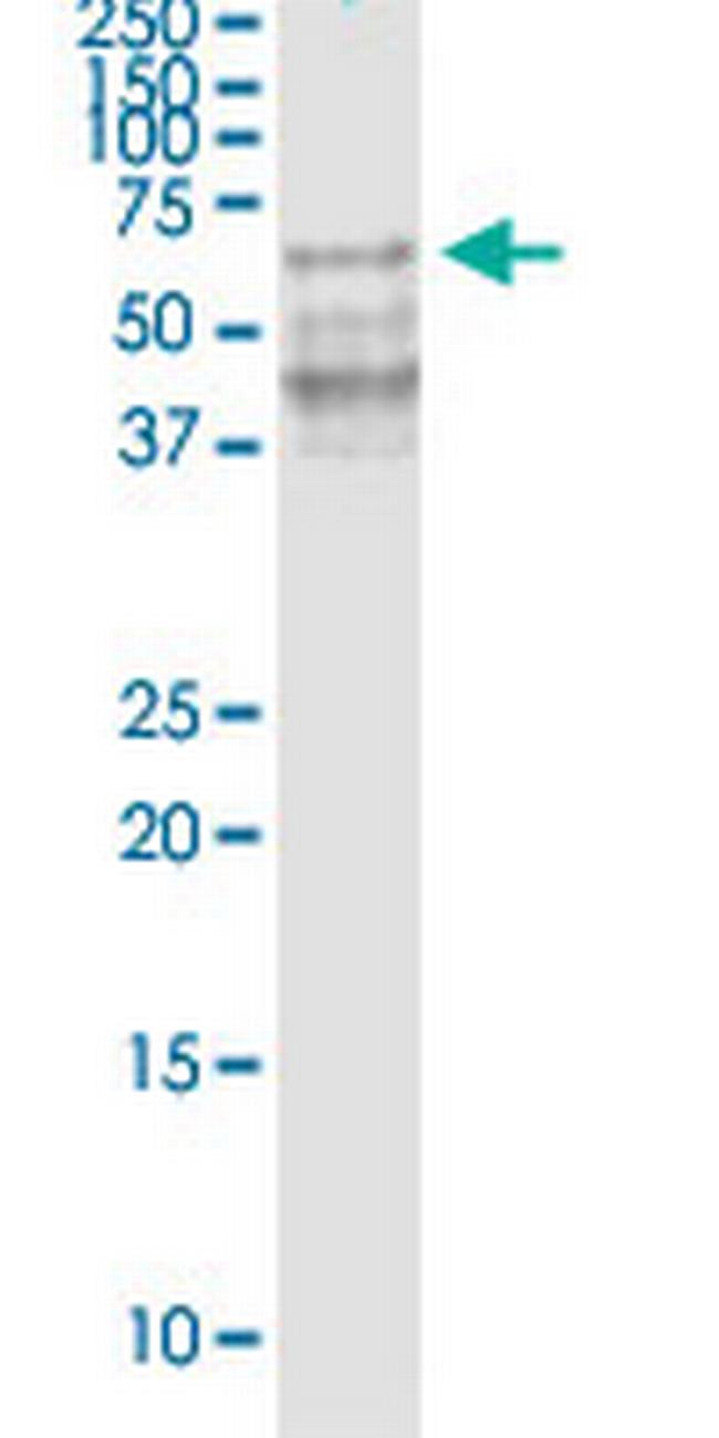 GDF5 Antibody in Western Blot (WB)