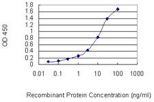CHAF1B Antibody in ELISA (ELISA)