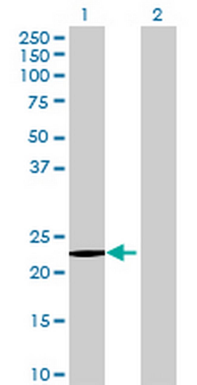 HDHD1A Antibody in Western Blot (WB)