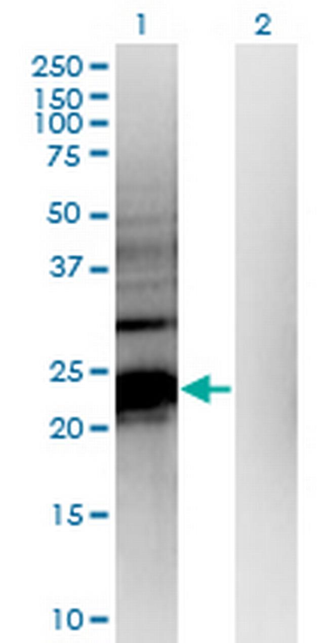 HDHD1A Antibody in Western Blot (WB)