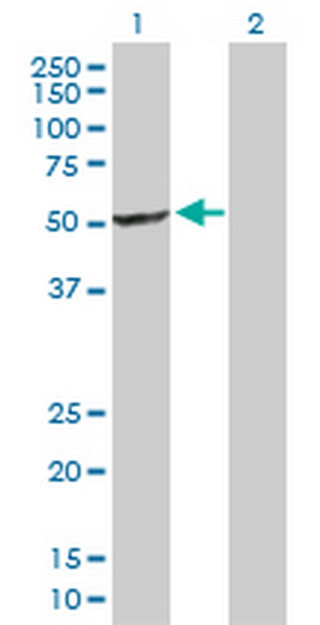 SFRS17A Antibody in Western Blot (WB)