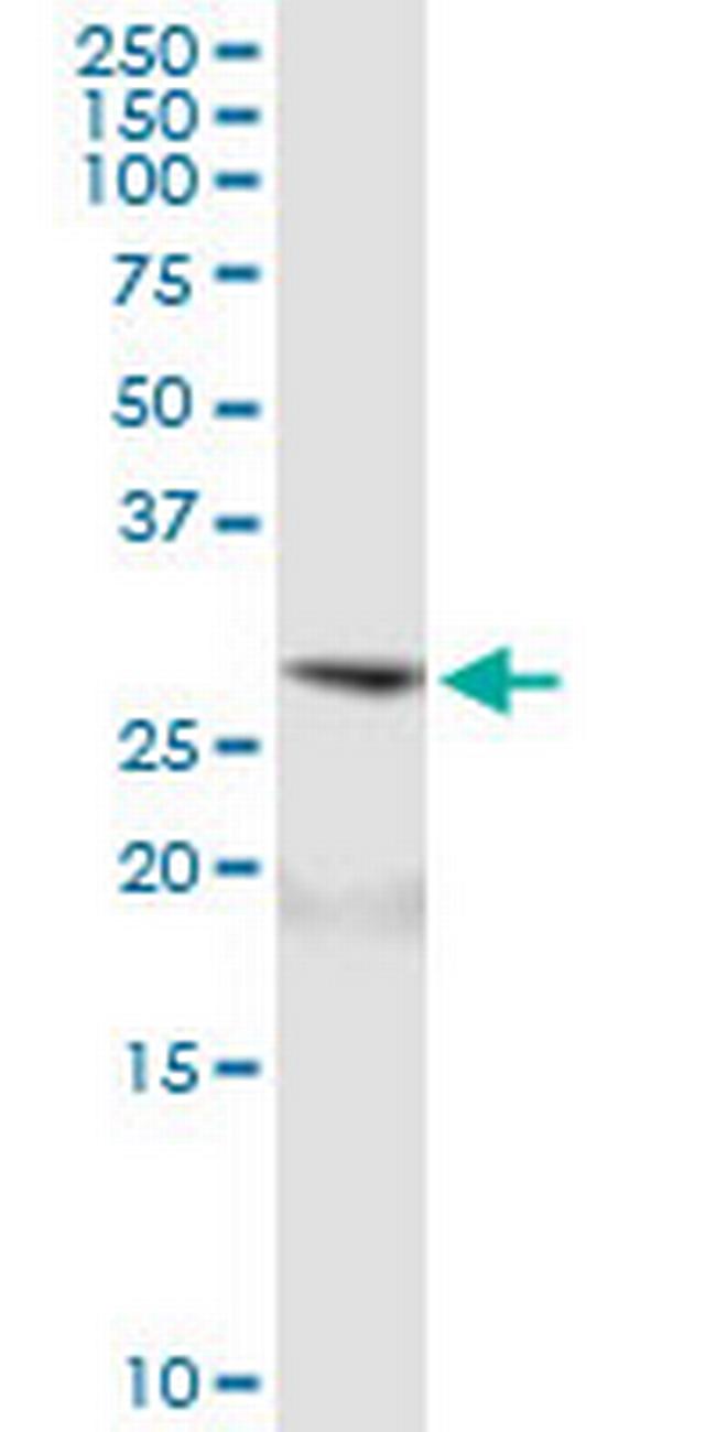 ARD1A Antibody in Western Blot (WB)