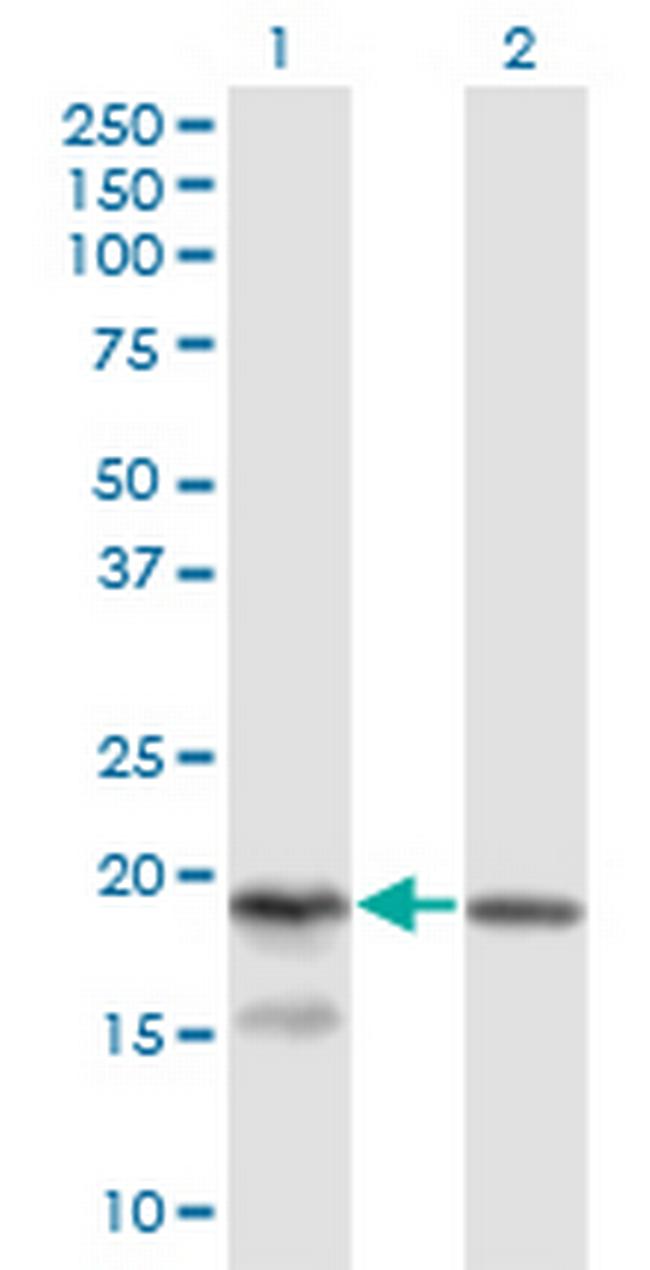 KLRC4 Antibody in Western Blot (WB)