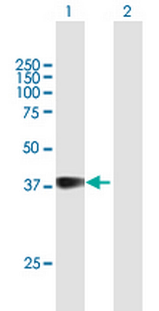 GFI1B Antibody in Western Blot (WB)