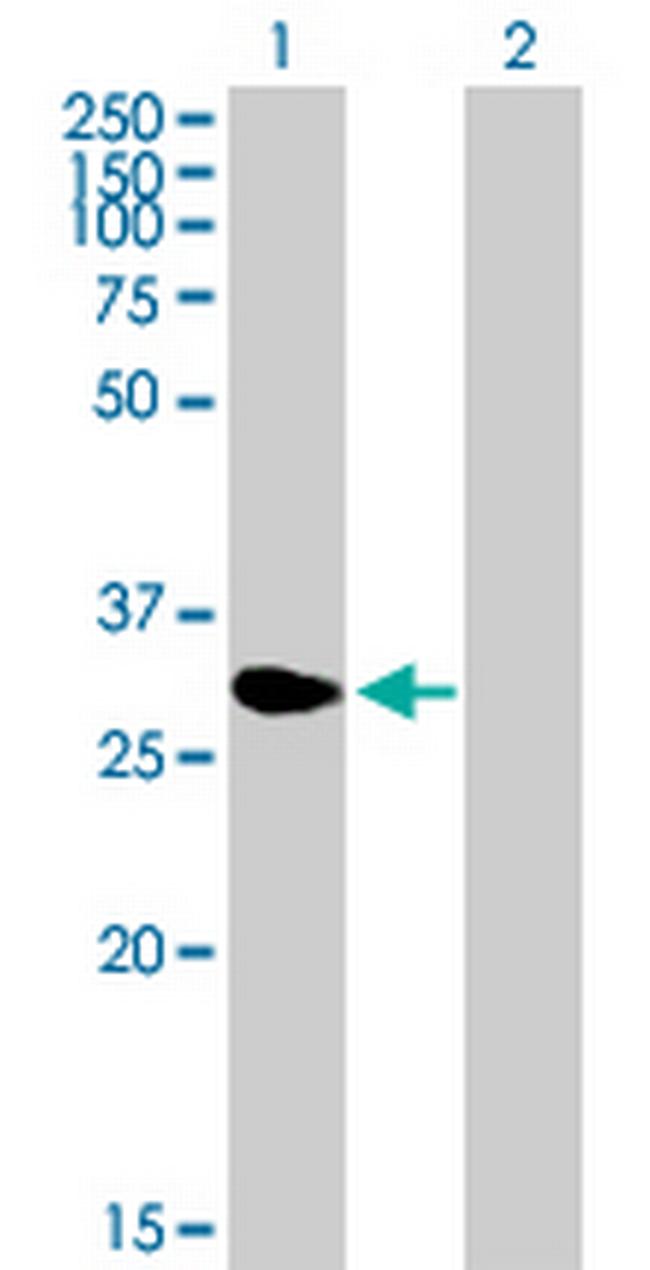 NME5 Antibody in Western Blot (WB)
