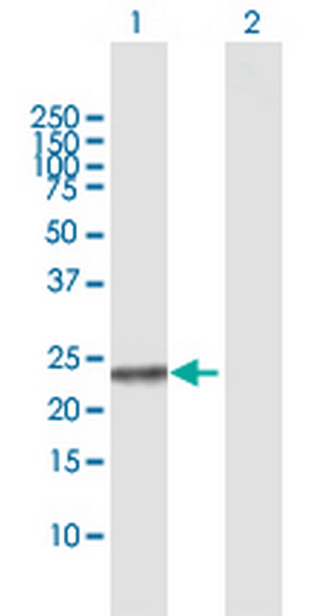 NME5 Antibody in Western Blot (WB)
