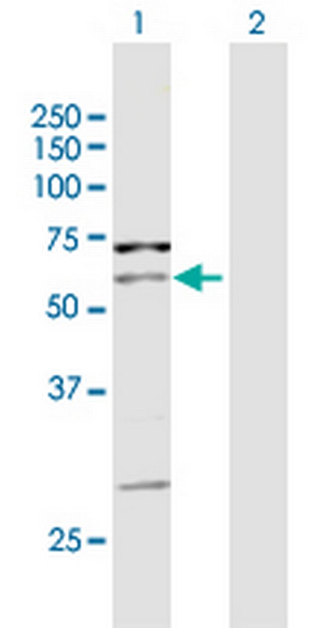 PIP5K1A Antibody in Western Blot (WB)
