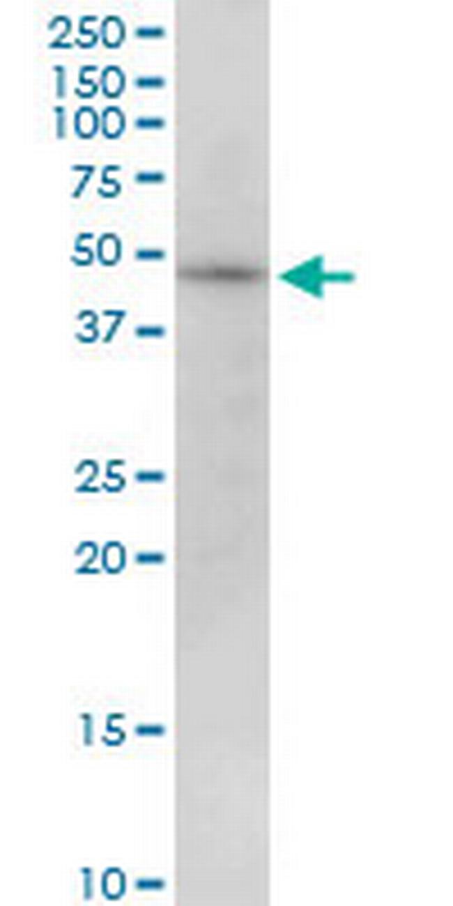 PIP4K2B Antibody in Western Blot (WB)