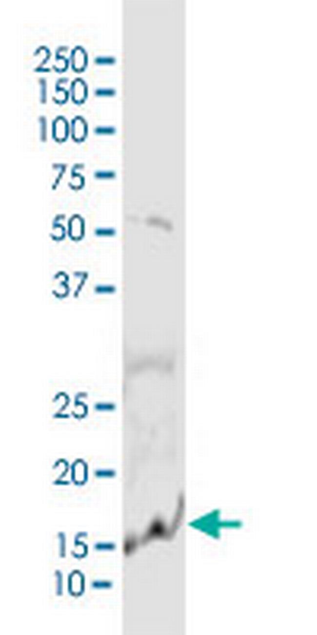 PLA2G10 Antibody in Western Blot (WB)