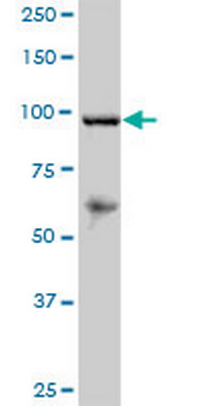 RECK Antibody in Western Blot (WB)