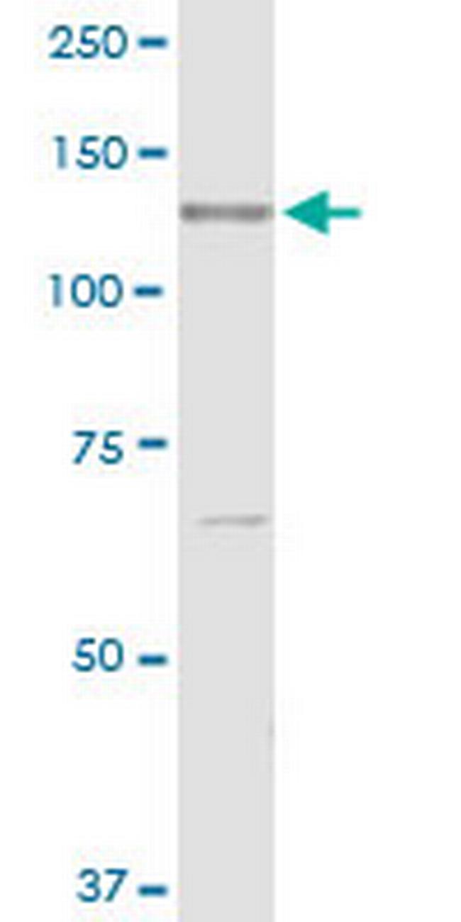RECK Antibody in Western Blot (WB)