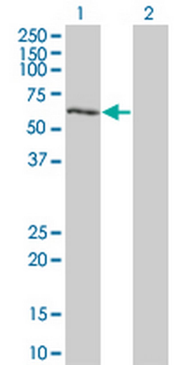DYRK2 Antibody in Western Blot (WB)