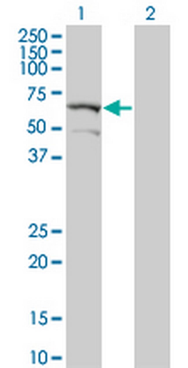 DYRK2 Antibody in Western Blot (WB)