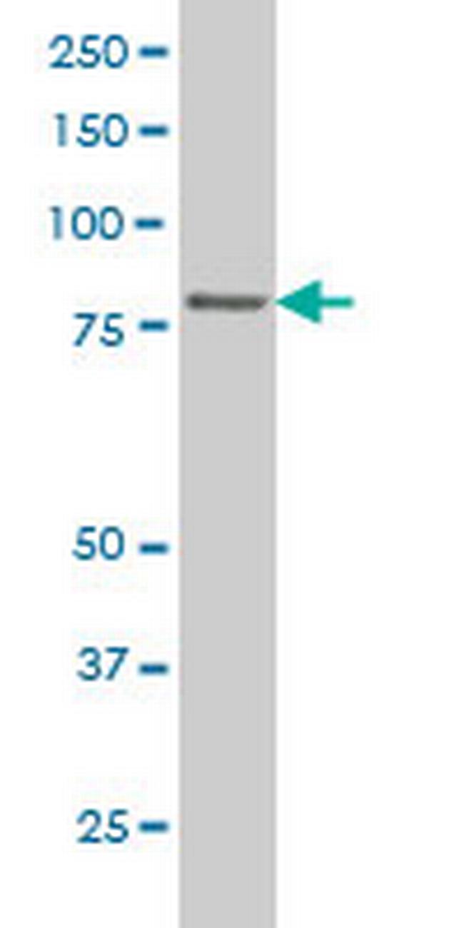 TTF2 Antibody in Western Blot (WB)