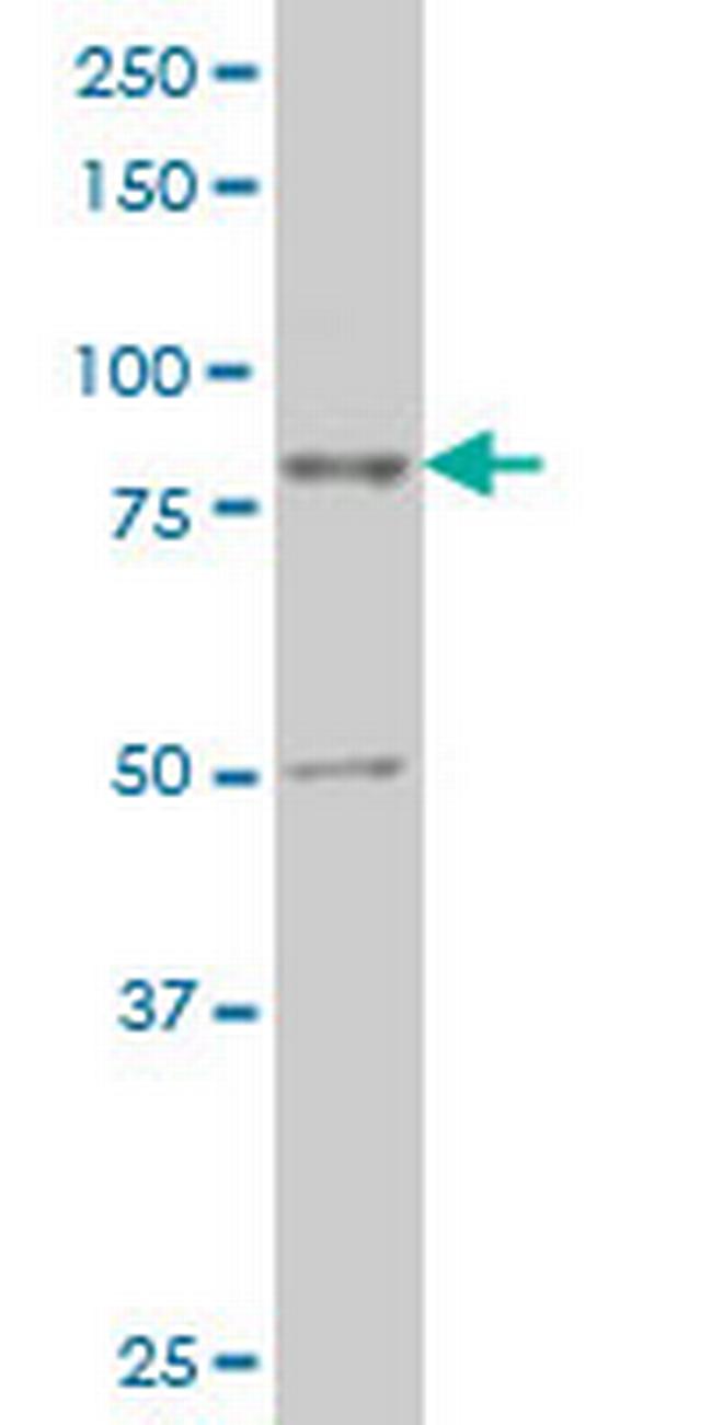 TTF2 Antibody in Western Blot (WB)