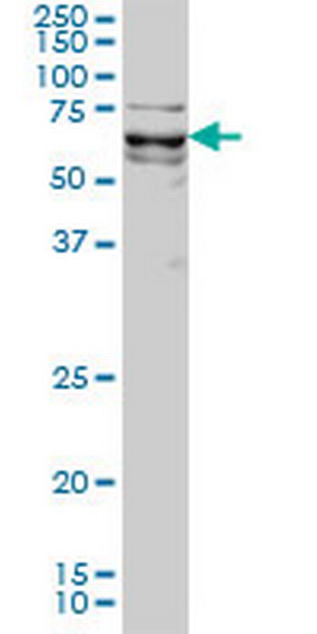 KLF11 Antibody in Western Blot (WB)