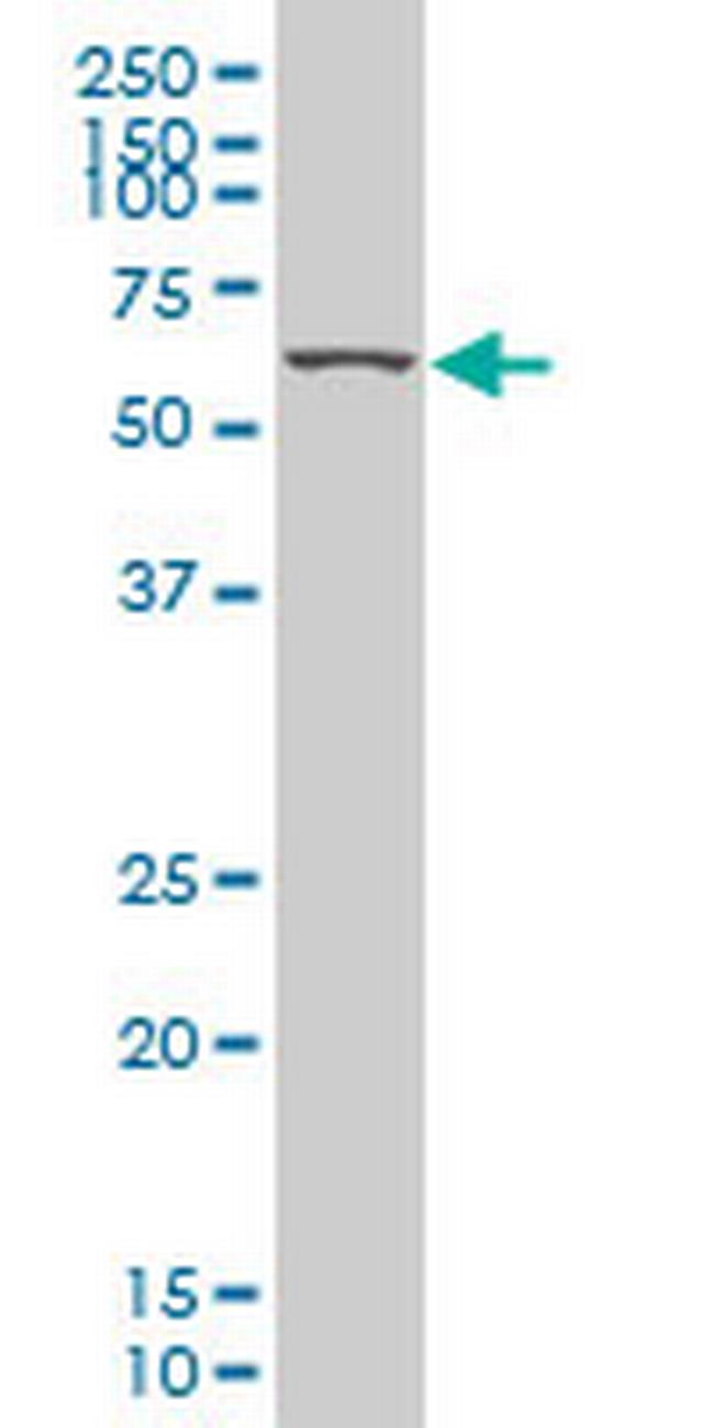 KLF11 Antibody in Western Blot (WB)